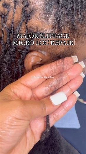 69K views · 188 reactions | What causes this? In this case these...