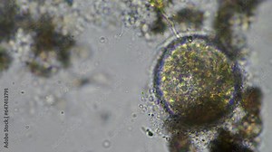 soil microorganisms close up under the microscope. in a soil samlple from a farm