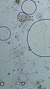 22K views · 142 reactions | Soup under a microscope… What’s next??? #science #fyp #experiment | RHCB Experiments | Facebook