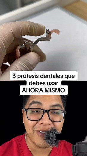 Tipos de prótesis dentales y sus beneficios explicados