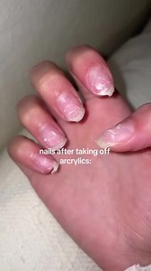 Candy Claws™ Press On Nails on Instagram: "A dream come true for nail lovers! 🤩 Our trendy af press-on nails are: 🌎 Reusable 💪🏻 Lasts 2-3 weeks per set 😍 Salon perfect nails at home ✨ Easy application & removal 🐰 Vegan + Cruelty free We have a huge range of salon quality nails that are sure to suit anyone's style! Your perfect nail is waiting for you! ✨Discover your new favourite mani at Candy Claws. 😘"