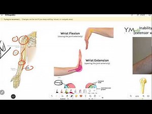 Humeral Fractures |Ortho|