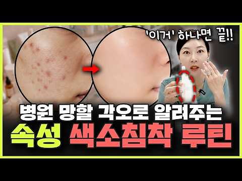 No Ads❌) Fast Results Guaranteed! A Miracle Routine to Clear Hyperpigmentation at Home | You Won'...