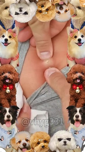 Cyst and Pimple Removal Techniques