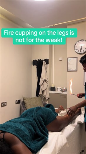 Cupping Therapy for Deep Leg Tension Relief