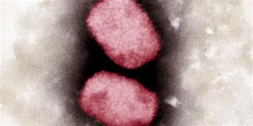 What is mpox? A microbiologist explains what’s known about this smallpox cousin