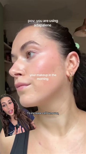 Dermatologist's secret for bumpy and textured skin!🤭👩🏽‍⚕️ #dermatologist #skincare #acnetreatment