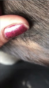 12K views · 104 reactions | Big Lice Removal | Videos Hunny | Facebook