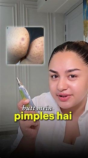 Another reason to try out this viral yellow korean cream Celimax retinal shot 🫣