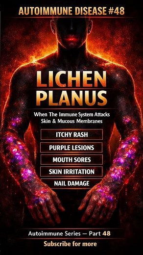 Lichen Planus Explained | When the Immune System Attacks Skin & Mucous Membranes
