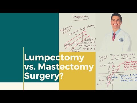 Lumpectomy or mastectomy?