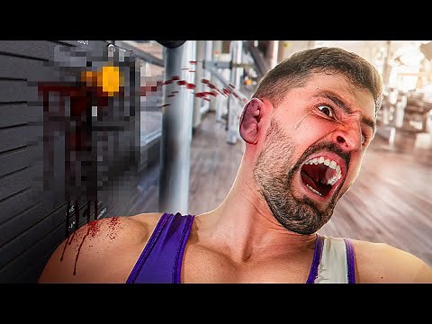 The Worst Injuries You Can Get In The UFC!