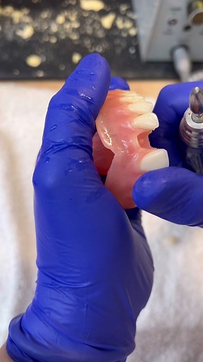 Easy same day repair. 😊 #viral #satisfying #dental #fyp