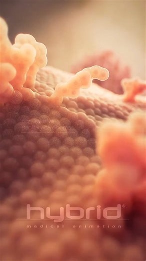 World of Biology on Instagram: "Non-invasive papillary carcinomas Here within the bladder’s microenvironment, we can see clusters of thin, delicate, stalk-like projections extending outward from the bladder wall. These structures, known as non-invasive papillary carcinomas, remain superficial, anchored to the transitional epithelium (urothelium) — a fragile layer that acts as a barrier between the bladder’s interior and surrounding tissues — and where most bladder cancers begin. Our journey cont