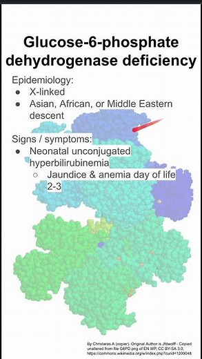 Glucose-6-phosphate dehydrogenase deficiency