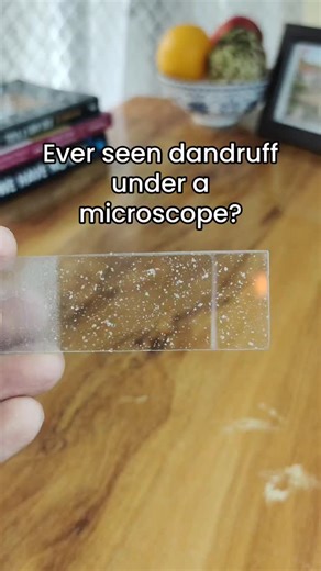 Suraj Radhakrishnan | Dandruff Under Microscope Ever wondered what dandruff really looks like? Under the microscope, it’s not just white flakes — it’s a whole... | Instagram