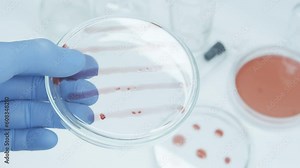 Bacteria and microbial cultures growth on a petri dish in microbiology lab. Candida auris. Biomarker. Bio-reagent. Fungus and mold. Cyanobacteria Colony. Culture medium plate.
