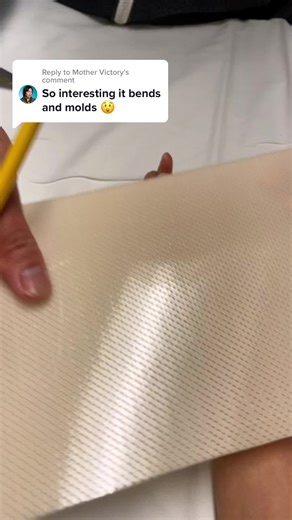 Replying to @Mother Victory I get a custom splint every time! After I get it, i also try it out for a few days to see if it digs into any parts of my arm or needs to get adjusted #BrachialPlexusInjury #OccupationalTherapy #OT #Splint #WristSplint