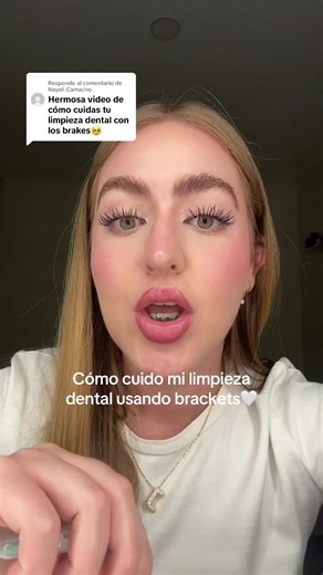Cómo cuidar la limpieza dental con brackets: guía práctica
