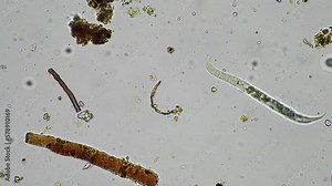 soil nematodes, fungi and microorganisms in a soil and compost sample Stock Video