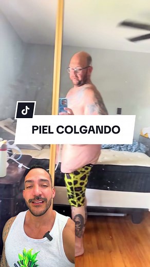 Cómo Tratar la Piel Colgando y Mejorar Tu Salud