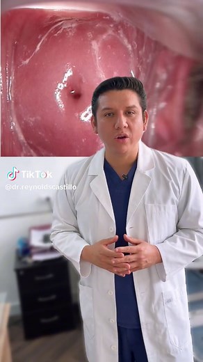 Salud del cuello uterino: causas y soluciones efectivas