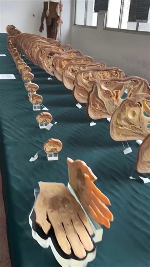 This Frozen Corpse Teaches Doctors About Human Anatomy! (@mcv.ufes)