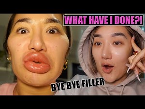GETTING MY FILLERS REMOVED.. I AM IN *SHOCK* | VLOG WEEK 106