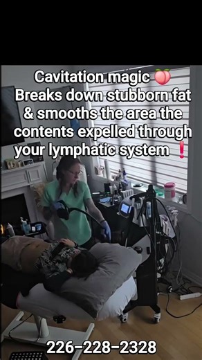 Laser lipo + cavitation in action! Non-invasive contouring for smoother, sculpted results.