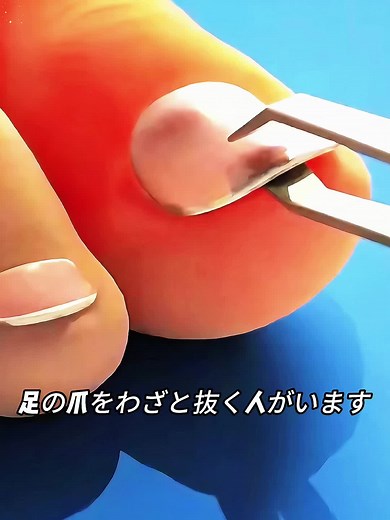 マラソン前の爪トラブルと委託対策