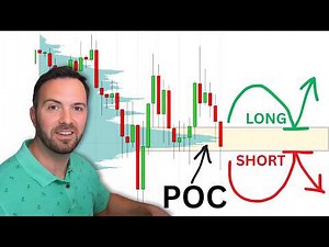 VOLUME PROFILE: How to Trade Point of Control (POC)