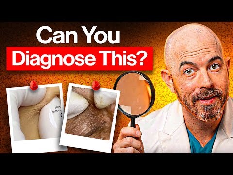 Understanding Skin Conditions: Medical Perspective & Education