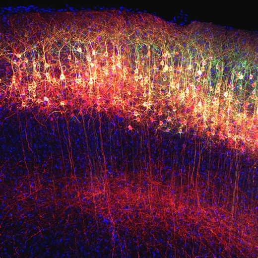 UW-Madison’s Cool Science Image Contest: Waisman winners