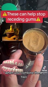 ⚠️These can help stop receding gums⚠️ #recedinggums #gumhealth #plaqueremoval https://miraherbals.info/products/gum-relief-oil?_pos=2&_psq=gum&_ss=e&_v=1.0 | Healthy Hair made easy