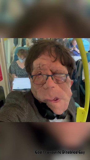 Celebrity MasterChef: Adam Pearson Teases Exciting Episode Tonight!