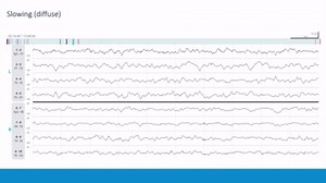 EEG Atlas B2: Become a Comfortable EEG Reader