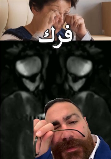 فرك العيون: المخاطر وكيف تحافظ على صحة عينيك