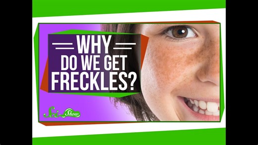 Why do we get freckles?