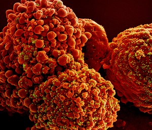 Persistent COVID Cases Seem to Encourage Viral Mutations | Genetics And Genomics