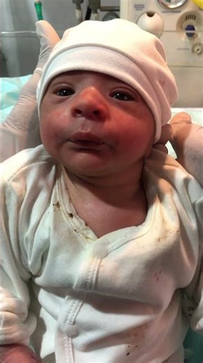 “Adorable Baby Recovered & Going Home 🏡💕 | NICU Journey #NICUBaby #Recovery”