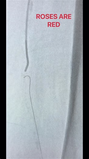 That Vascular Life 🩸 🔪 on Instagram: "Skeeeeellz. . . #vascular #vascularsurgery #vascularsurgeon #orlife #surgery #operatingroom #surgeonlife #surgeon #surgical #surgerylife #fluoro #angio #angiography #cath #cathlab #endovascular #stent #surgicaltechnologist #scrubtech #scrubnurse #ornurse #surgicalnurse #medicaldevices #medicaldevice #redhatgang #doctor #doctorlife #scrubs #scrubslife"