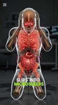 What would really happen if a human stopped sleeping completely?