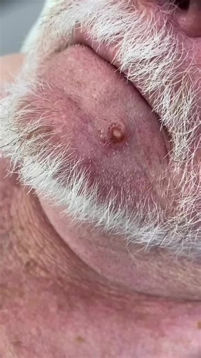 skincancerdoctor on TikTok