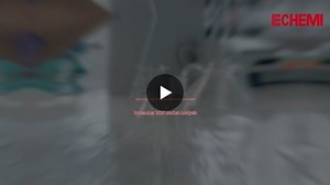 Glacial Acetic Acid: The "Acid Test" of Market Balance 🧪📉