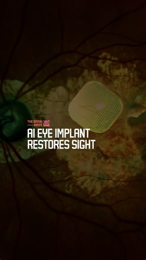 AI Eye Implant Restores Sight to the Blind - A new AI-powered eye implant has given sight back to the blind. The PRIMA device restores central vision lost to geographic atrophy, letting patients read again after years of darkness. According to studies published in The New England Journal of Medicine and led by UCL and Moorfields Eye Hospital, 84 percent of participants could once more recognize letters, numbers, and words. Each chip, smaller than a grain of rice, converts light into electrical s
