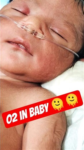 New born baby O2 in 🫠🫠#PritamBaby #BabyLove #CutestBaby #BabyMoments #TrendingShorts #ViralBaby 👌🏾👌🏾