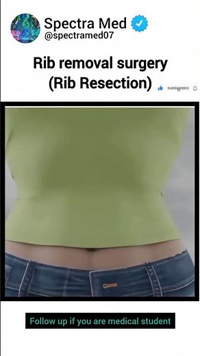 Rib Removal Surgery Explained |How Rib Resection Relieves Pressure & Pain #anatomy #science #biology