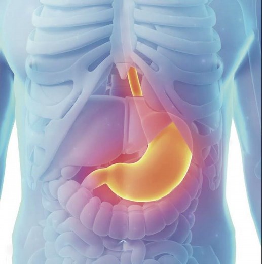 Gastroesophageal reflux disease (GERD)
