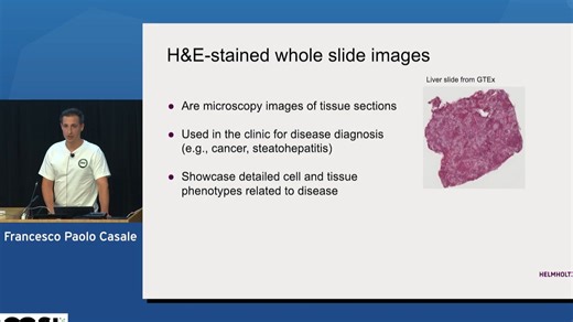Francesco Paolo Casale || 人工智能成像遗传学和遗传学因果推断 || CGSI 2025