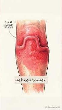 Two Infections, Two Completely Different Dangers #infection #health #ER